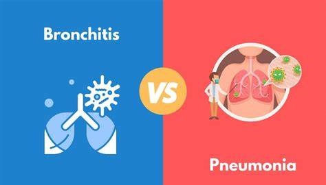 Sự khác nhau giữa viêm phổi và viêm phế quản là gì?